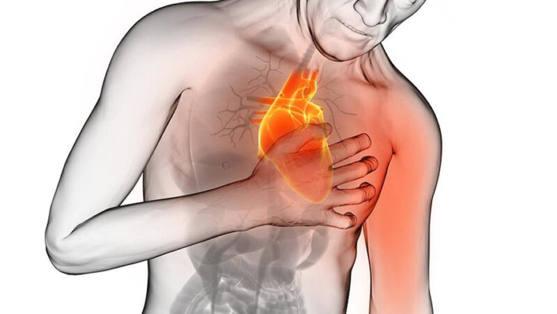 خناق الصدر الجهدي والمتلازمة الإكليلية الحادة
