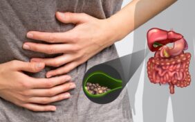 حصى الكلى أسبابها وعلاجها