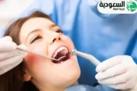 عيادات الأسنان في الرياض