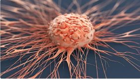 نظام TAR-200: العلاج المبتكر لسرطان المثانة