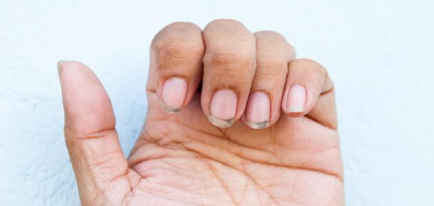 الأظافر في المنام: تفسير الأحلام