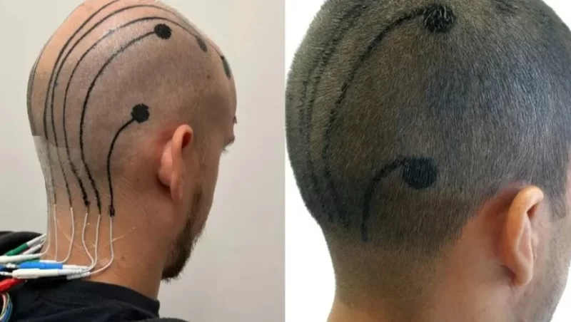 الوشم الإلكتروني: رصد مستمر للدماغ لمدة 24 ساعة