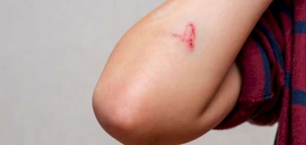 الدليل الشامل في تفسير الأحلام: كل ما تريد معرفته عن رؤية الجروح