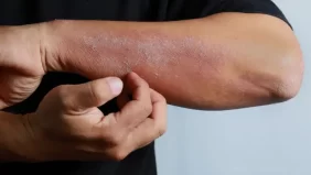 الأمراض الجلدية عند الرجال: تغييرات بسيطة لحياة أفضل