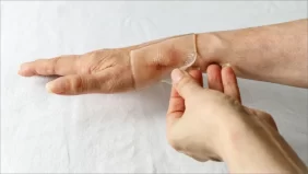 الضمادات: أنواعها، فوائدها، وكيفية استخدامها بشكل صحيح