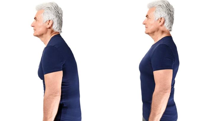 تحسين القوام: الوقاية من المشاكل الصحية وتحسين جودة الحياة