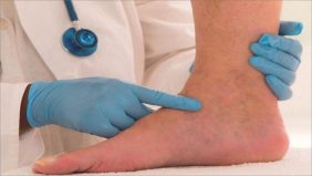 علامات تدل على وجود مشكلة في الجهاز اللمفاوي