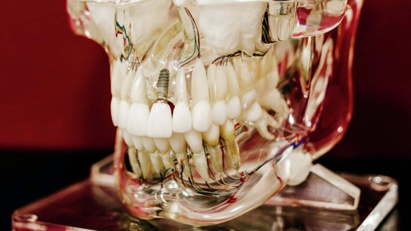 الأمل يعود: دواء جديد لإعادة نمو الأسنان للأطفال والبالغين