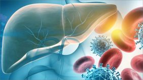 التهاب الكبد الحاد: هل يمكن الشفاء منه؟ وما هي الخيارات العلاجية؟
