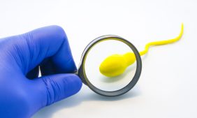 انعدام الحيوانات المنوية: كل ما تود معرفته