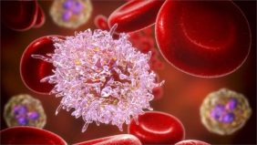 سرطان الدم: من التشخيص إلى التعافي، كل ما تحتاج معرفته