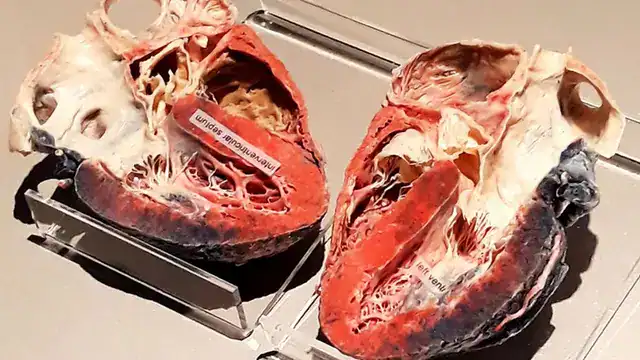 الزجاج الأيوني: تقنية واعدة لتشخيص الأمراض وعلاجها