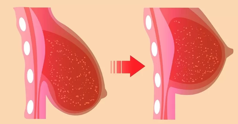 تدلي الثدي وجمال المرأة: نصائح للحفاظ على شكل الصدر الجذاب
