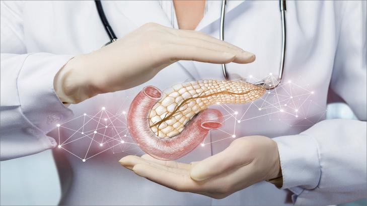 سرطان البنكرياس: أسئلة شائعة وإجابات مهمة