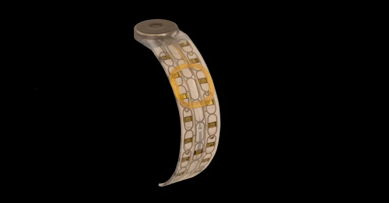 قصص نجاح ملهمة بفضل زراعة العضلات في الأطراف الصناعية