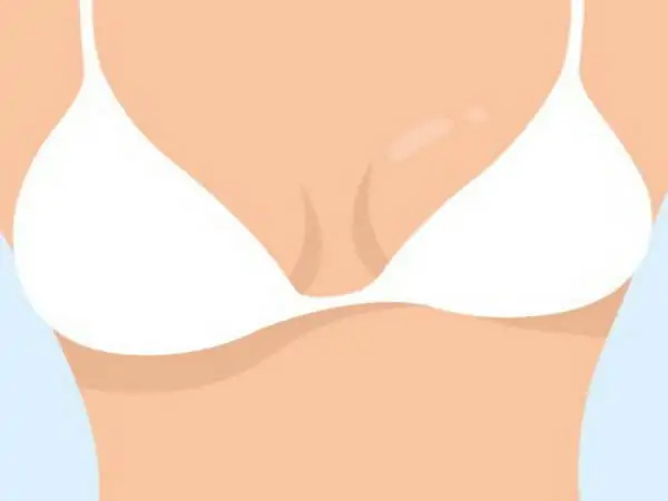 تباين حجم الثدي: الأسئلة الشائعة والإجابات المفصلة