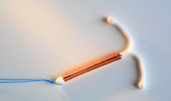 كل شيء عن اللولب النحاسي والدورة الشهرية: دليل مبسط