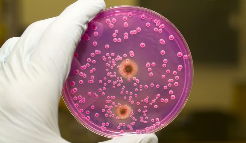 الفطريات المهبلية: دليل المرأة المتزوجة الشامل