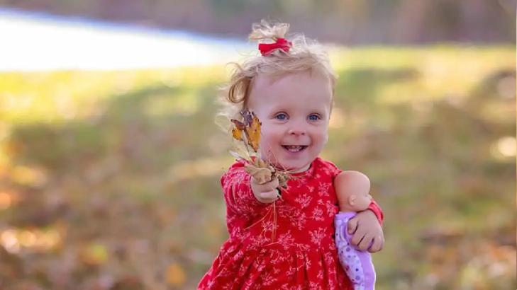 كل ما تحتاج معرفته عن متلازمة تيرنر: الأعراض والتشخيص والعلاج