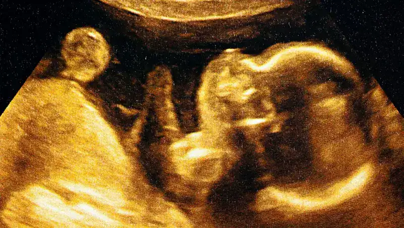 وراثة وتغذية: دور الجنين في تحكمه بالمغذيات وتطور النمو