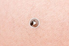 هل الديتول يقتل البراغيث؟ تحليل عميق لفعاليته.