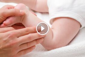 حلول طبيعية ومنزلية لـ علاج قرص البق للأطفال بآمان