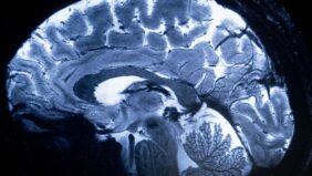 مستقبل واجهات الدماغ والحاسوب: نحو تفاعل أعمق بين الإنسان والآلة