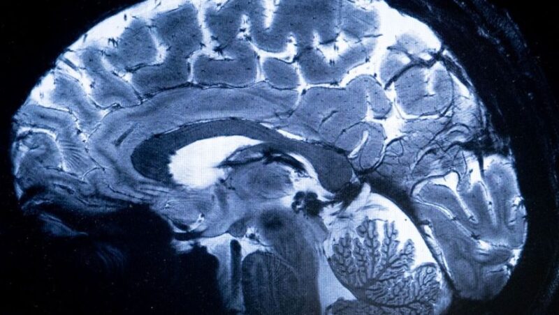 مستقبل واجهات الدماغ والحاسوب: نحو تفاعل أعمق بين الإنسان والآلة