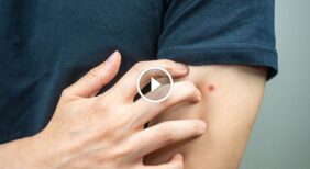 دليل شامل للتعامل مع مخاطر بق الفراش والعيش بأمان