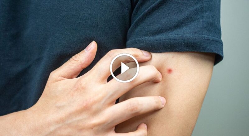 دليل شامل للتعامل مع مخاطر بق الفراش والعيش بأمان