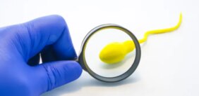 وداعاً لقلة الحيوانات المنوية: كل ما تحتاج لمعرفته لزيادة العدد