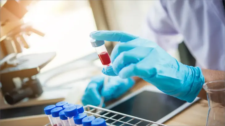 وداعاً للأمراض المزمنة: سر فحص الدم الدوري المنتظم