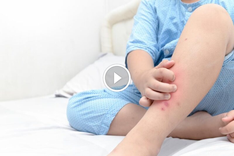 بق الفراش: تعرف على أعداء نومك وطرق التخلص منهم للأبد