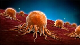 العيش مع مرض السرطان: دعم شامل للمرضى ومقدمي الرعاية