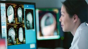 دليل المريض الشامل: التعامل مع الصرع الفصي الصدغي