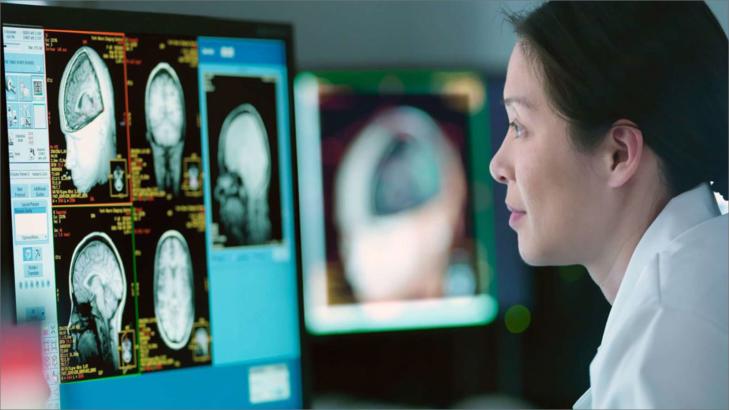 دليل المريض الشامل: التعامل مع الصرع الفصي الصدغي