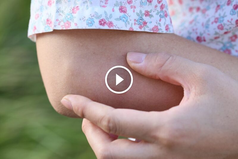 حماية من قرصة البق: استراتيجيات فعالة لمكافحة الآفات