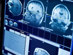 من اليقطين إلى الدماغ: رحلة التصوير بالرنين المغناطيسي إيزولت