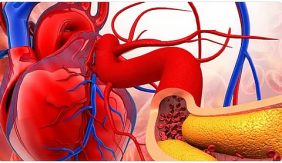 مستقبل صحي: استثمر في الوقاية من تصلب الشرايين الآن!