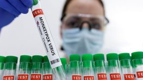 فيروس جدري القرود المتحور: آخر المستجدات والاكتشافات