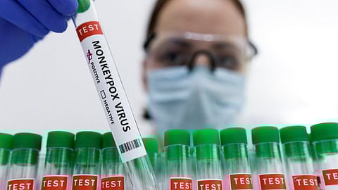 فيروس جدري القرود المتحور: آخر المستجدات والاكتشافات