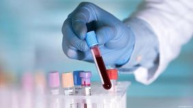 هيئة الصحة العامة: فحص ما قبل الزواج خطوة بسيطة تحمي أسرتك ومستقبل أبنائك