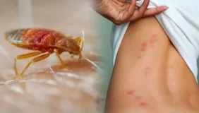 الأهمية البيئية لبق الفراش وتأثيره الصفري على التوازن البيئي