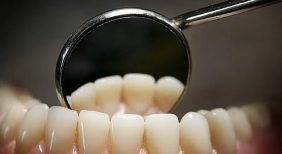 كيف تحمي أسنانك من التسوس العميق وعلاج العصب؟.. مختص يوضح