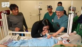 أسرار نجاح عملية فصل التوائم الملتصقة رقم 72 في السعودية
