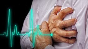 طرق الوقاية من الجلطة القلبية لضمان حياة صحية ومستقرة