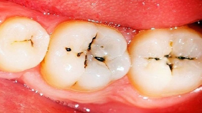 كيف تبدأ رعاية أسنانك من تحسين الصحة النفسية وصحة الفم؟
